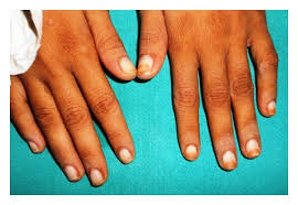 Image result for lunula nail