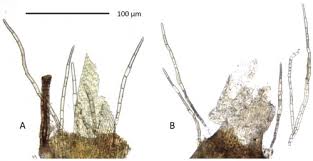 Attēlu rezultāti vaicājumam “Orthotrichum speciosum sporophyte”