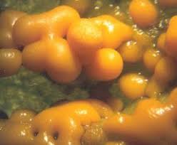 Attēlu rezultāti vaicājumam “Badhamia foliicola sessile”