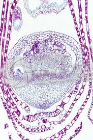 Attēlu rezultāti vaicājumam “Sphagnum centrale sporophyte”