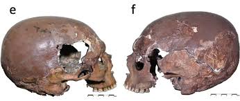 Image result for elongated skulls