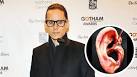 Leto Posts Pic of Fan's Severed Ear | ETonline.