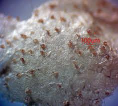 Attēlu rezultāti vaicājumam “Lycogala cf. fossiculatum”