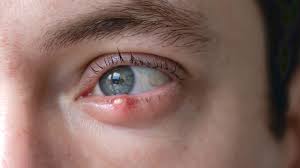 Image result for inthe.es