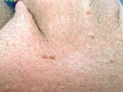 Image result for schamhaar