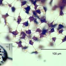 Attēlu rezultāti vaicājumam “Stemonitis marjana macro”