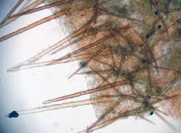 Attēlu rezultāti vaicājumam “Cheilymenia stercorea”