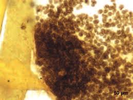 Attēlu rezultāti vaicājumam “Physarum bryocorticola sessile”