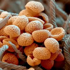 Attēlu rezultāti vaicājumam “Metatrichia floriformis spores”