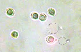 Attēlu rezultāti vaicājumam “Ramariopsis kunzei”