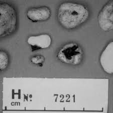 Attēlu rezultāti vaicājumam “Diachea subsessilis”