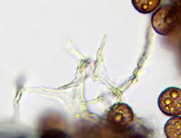 Attēlu rezultāti vaicājumam “Diderma subincarnatum”