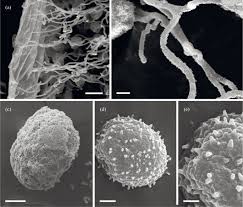 Attēlu rezultāti vaicājumam “Diderma hemisphaericum plasmodium”