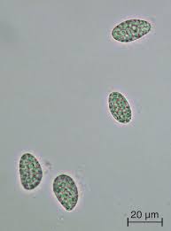 Attēlu rezultāti vaicājumam “Octosporella jungermanniarum”