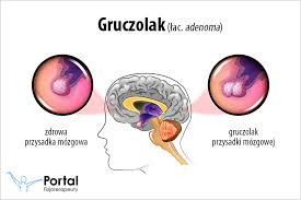 Image result for przyk adnica