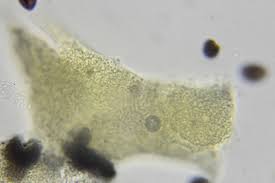 Attēlu rezultāti vaicājumam “Physarum nitens spores”