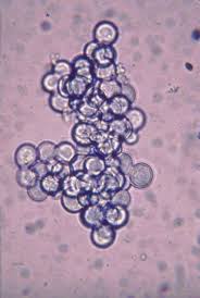 Attēlu rezultāti vaicājumam “Oligonema sp.”