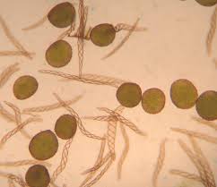 Attēlu rezultāti vaicājumam “Conocephalum salebrosum sporophyte”