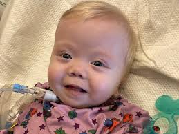 Attēlu rezultāti vaicājumam “Diderma umbilicatum young”