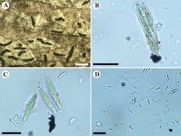 Attēlu rezultāti vaicājumam “Alyxoria varia”