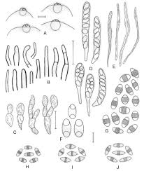 Attēlu rezultāti vaicājumam “Blepharostoma trichophyllum sporophyte”