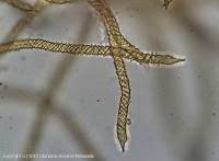 Attēlu rezultāti vaicājumam “Trichia scabra spores”