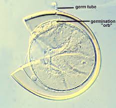Attēlu rezultāti vaicājumam “Gulielmina vermicularis spores”