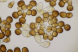 Attēlu rezultāti vaicājumam “Tranzschelia pruni-spinosae spores”