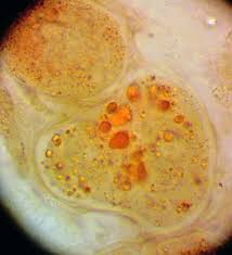 Attēlu rezultāti vaicājumam “Lycogala sphaeroconicum macro”