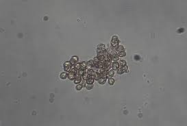 Attēlu rezultāti vaicājumam “Tubifera montana spores”