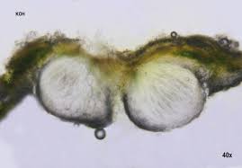 Attēlu rezultāti vaicājumam “Pertusaria leioplaca”