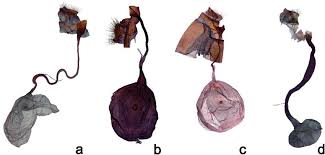Attēlu rezultāti vaicājumam “Catoptria verellus”