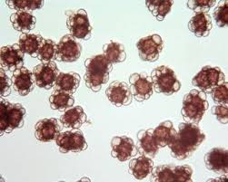 Attēlu rezultāti vaicājumam “Urocystis anemones spores”