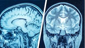 Image result for no brain