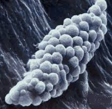 Attēlu rezultāti vaicājumam “Didymium serpula young”