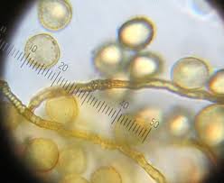 Attēlu rezultāti vaicājumam “Perichaena depressa spores”