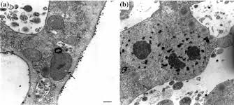 Attēlu rezultāti vaicājumam “Physarum obscurum plasmodium”