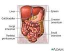 Peritonitis - symptoms, definition and treatment | Health Dictionary