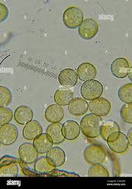 Attēlu rezultāti vaicājumam “Gulielmina vermicularis macro”