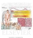 <b>Weil Disease</b>