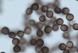 Attēlu rezultāti vaicājumam “Badhamia lilacina”