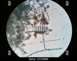 Attēlu rezultāti vaicājumam “Byssocorticium atrovirens”