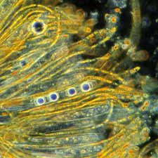 Attēlu rezultāti vaicājumam “Octospora humosa”