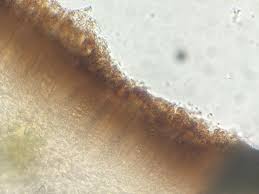 Attēlu rezultāti vaicājumam “Lecanora chlarotera”