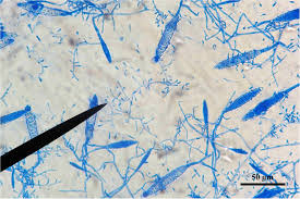 Attēlu rezultāti vaicājumam “Stemonitopsis aequalis var. microspora stalked”