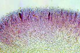 Attēlu rezultāti vaicājumam “Trapeliopsis flexuosa”