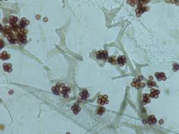 Attēlu rezultāti vaicājumam “Badhamia foliicola spores”