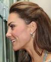 Kate Middleton reveals secret scar from her past What really