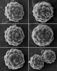 Attēlu rezultāti vaicājumam “Octospora splachnophila”
