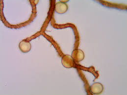 Attēlu rezultāti vaicājumam “Trichia contorta sessile”